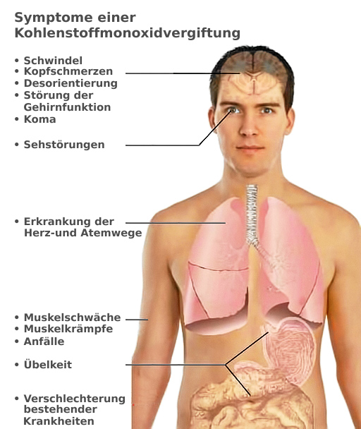 ©Wikipedia - Kohlenmonoxid Symptome